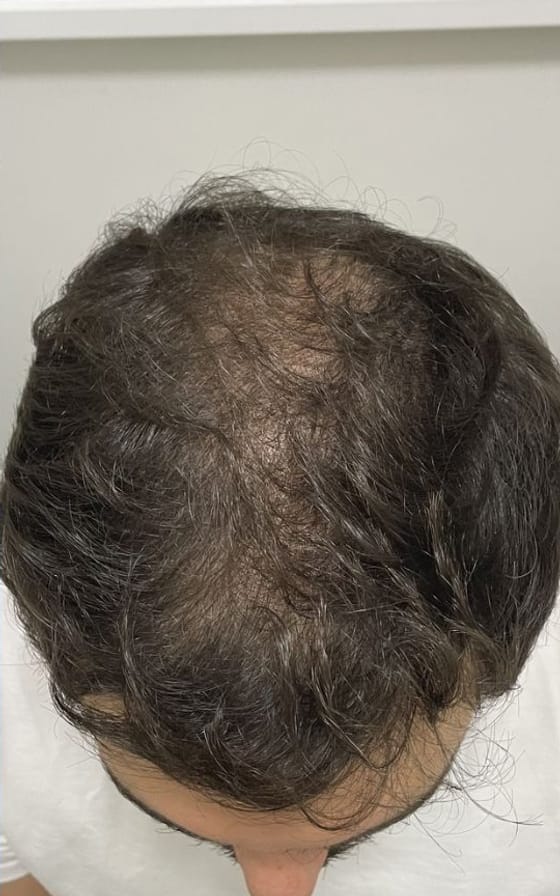 Tratamento Capilar, registro fotográfico 2