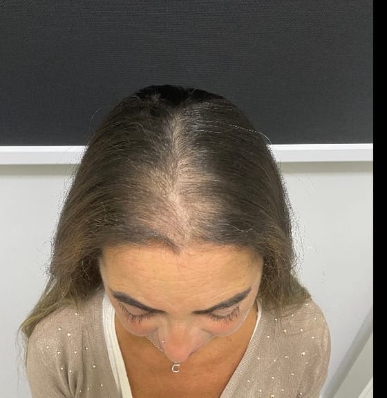Depois do tratamento de Tratamento Capilar
