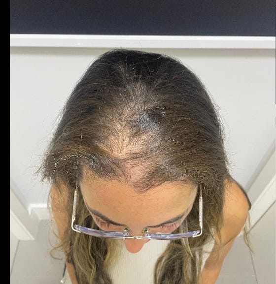 Tratamento Capilar, registro fotográfico 1