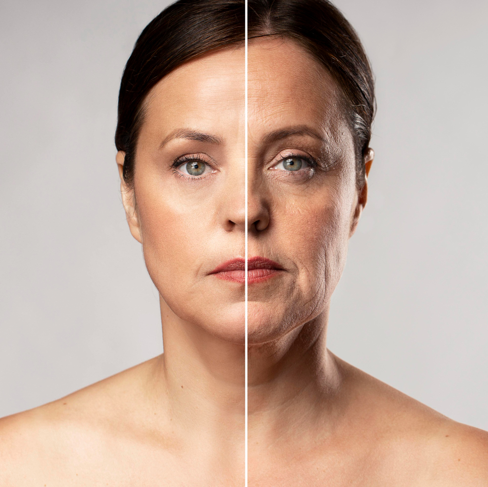 Harmonização Facial Integrada, procedimento realizado por dermatologista